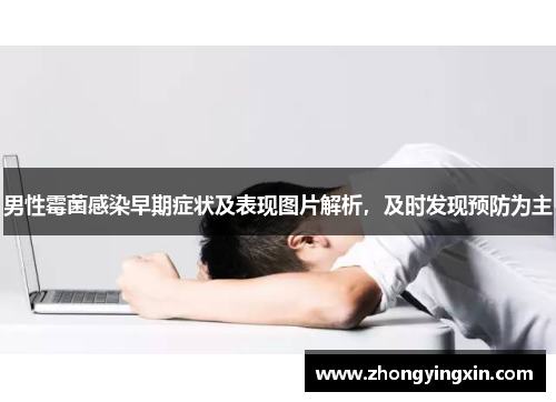 男性霉菌感染早期症状及表现图片解析，及时发现预防为主